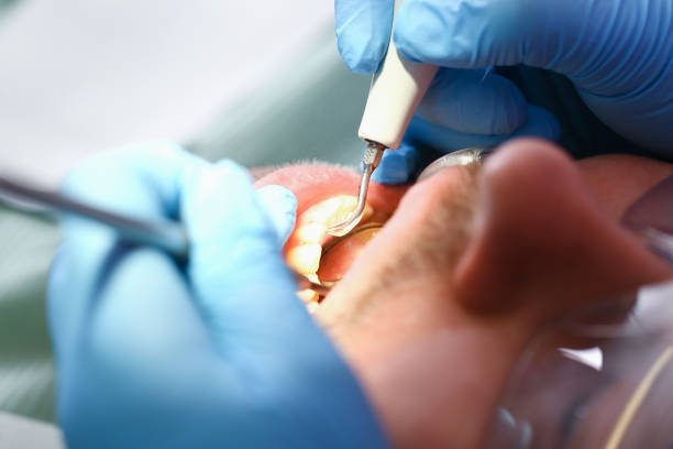 Best Dental Abscess Treatment in Westport Village, CT